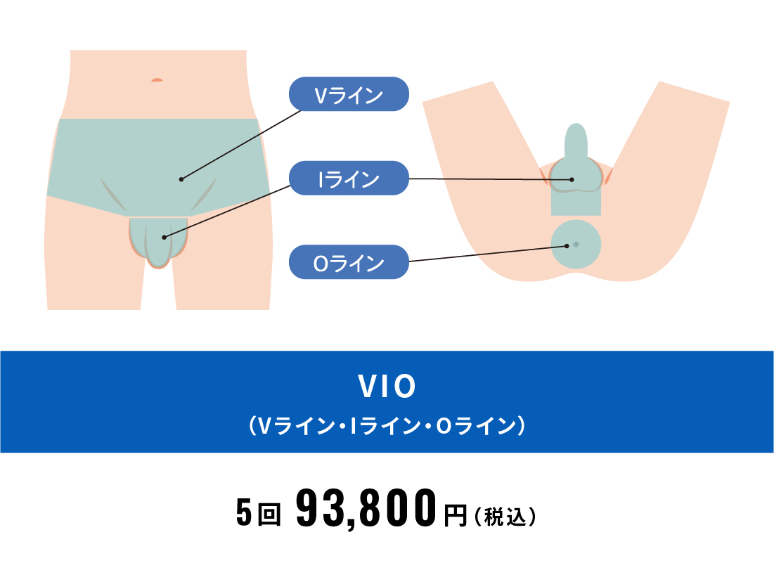 脱毛部位_VIO