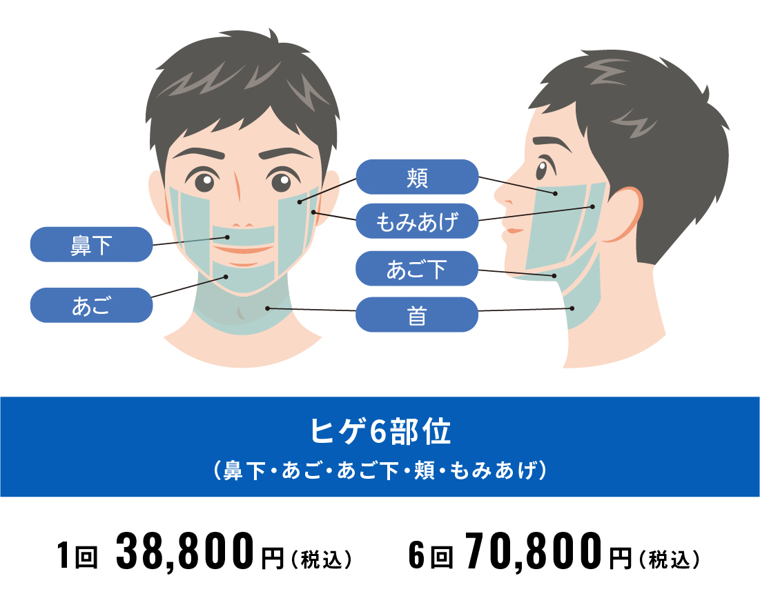 脱毛部位_ひげ