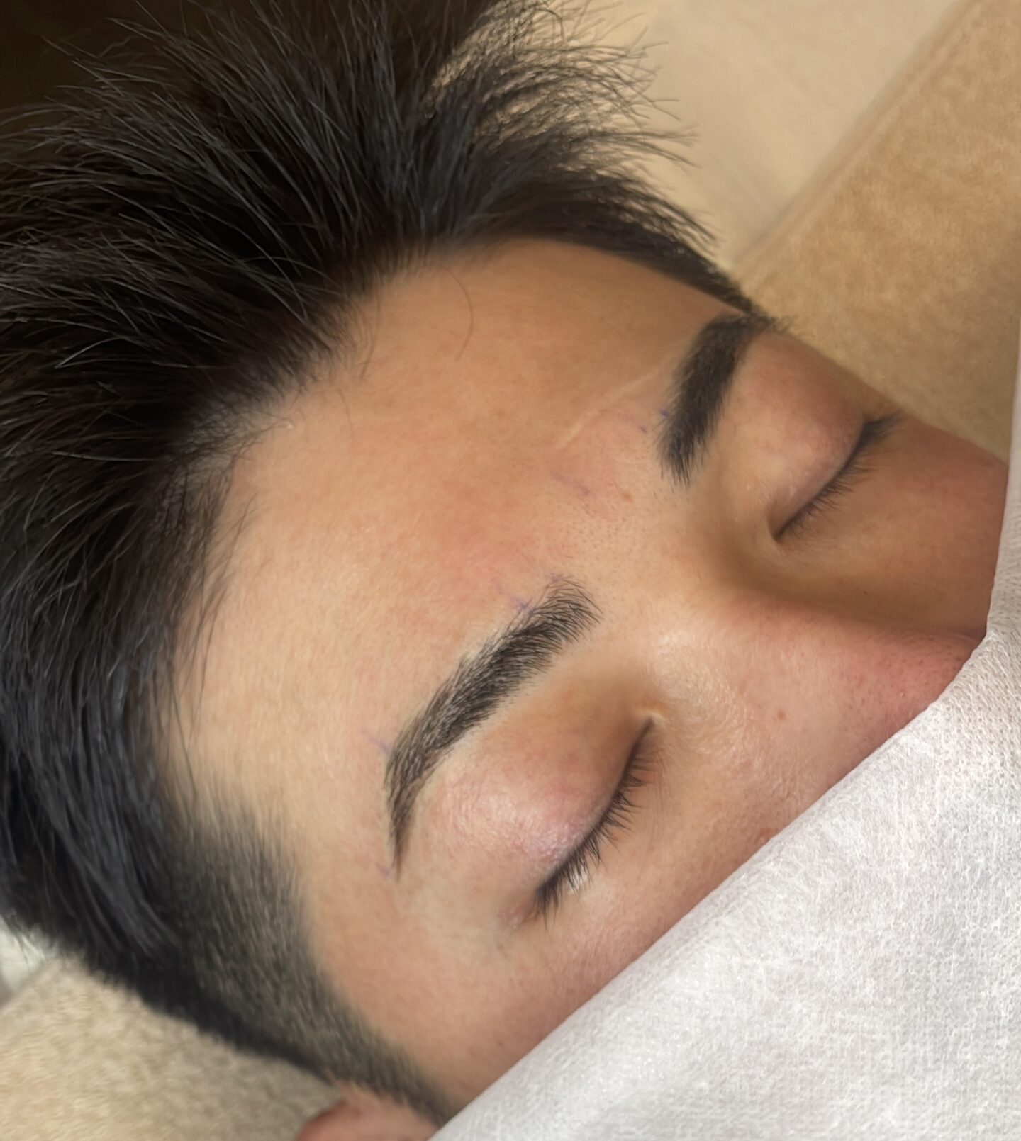 AFTER