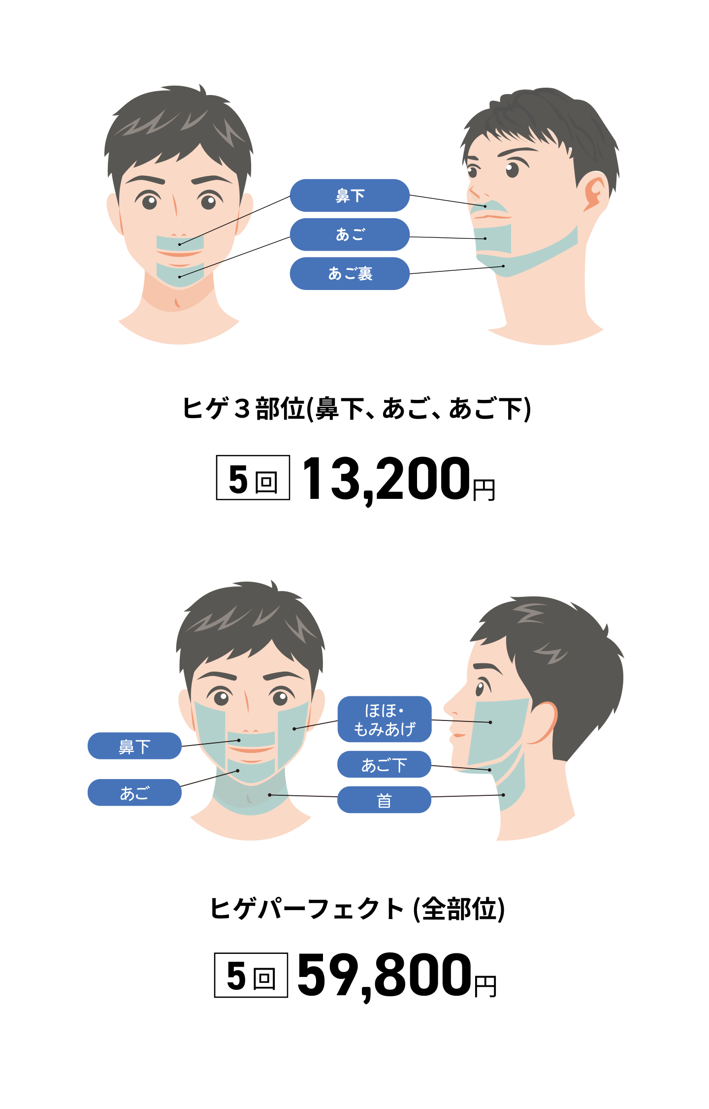 ヒゲ脱毛