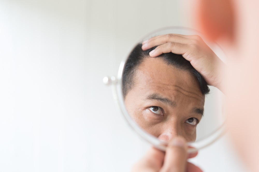 【AGA対策】ヘアサイクルを正常化するには？薄毛予防の最新知識